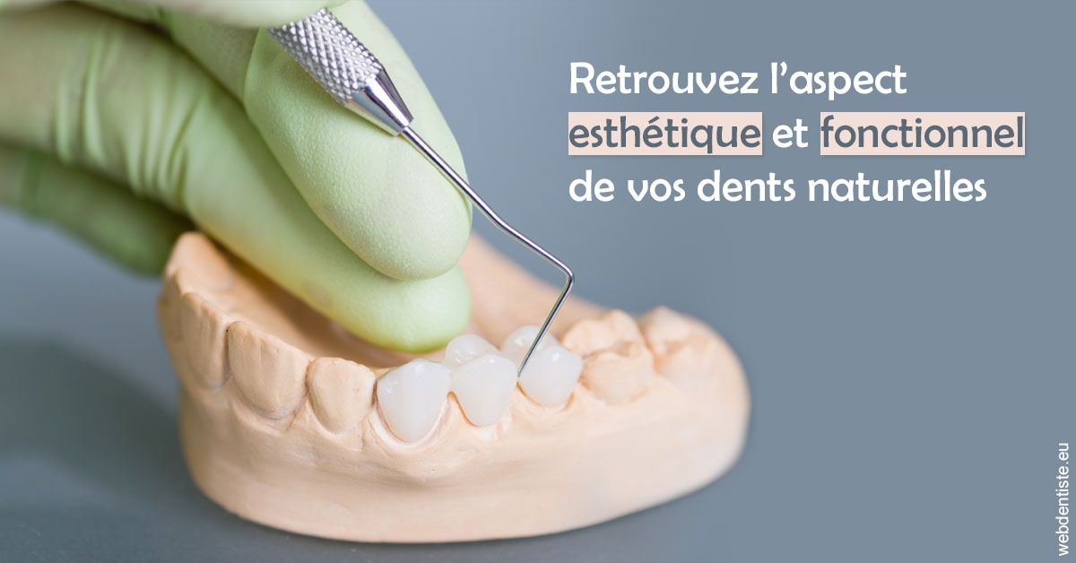 https://dr-zenou-stephane.chirurgiens-dentistes.fr/Restaurations dentaires 1