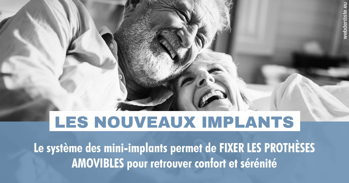 https://dr-zenou-stephane.chirurgiens-dentistes.fr/Les nouveaux implants 2