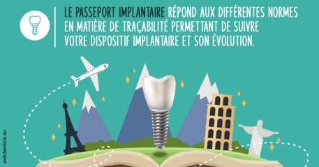 https://dr-zenou-stephane.chirurgiens-dentistes.fr/Le passeport implantaire