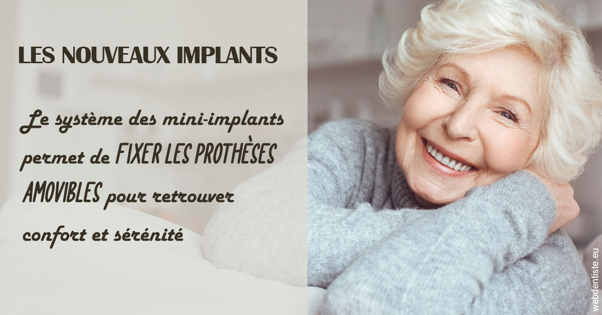 https://dr-zenou-stephane.chirurgiens-dentistes.fr/Les nouveaux implants 1