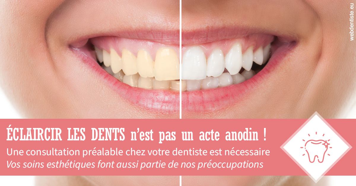 https://dr-zenou-stephane.chirurgiens-dentistes.fr/Eclaircir les dents 1