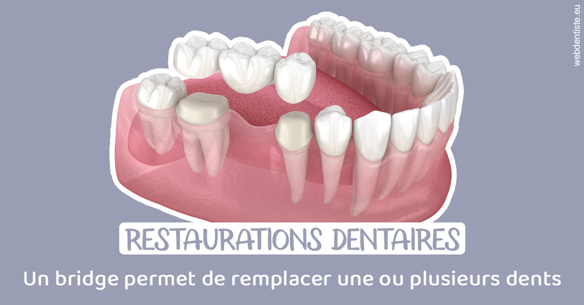 https://dr-zenou-stephane.chirurgiens-dentistes.fr/Bridge remplacer dents 1