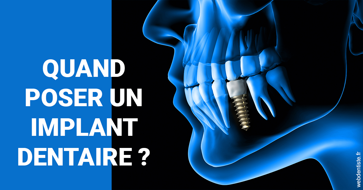 https://dr-zenou-stephane.chirurgiens-dentistes.fr/Les implants 1