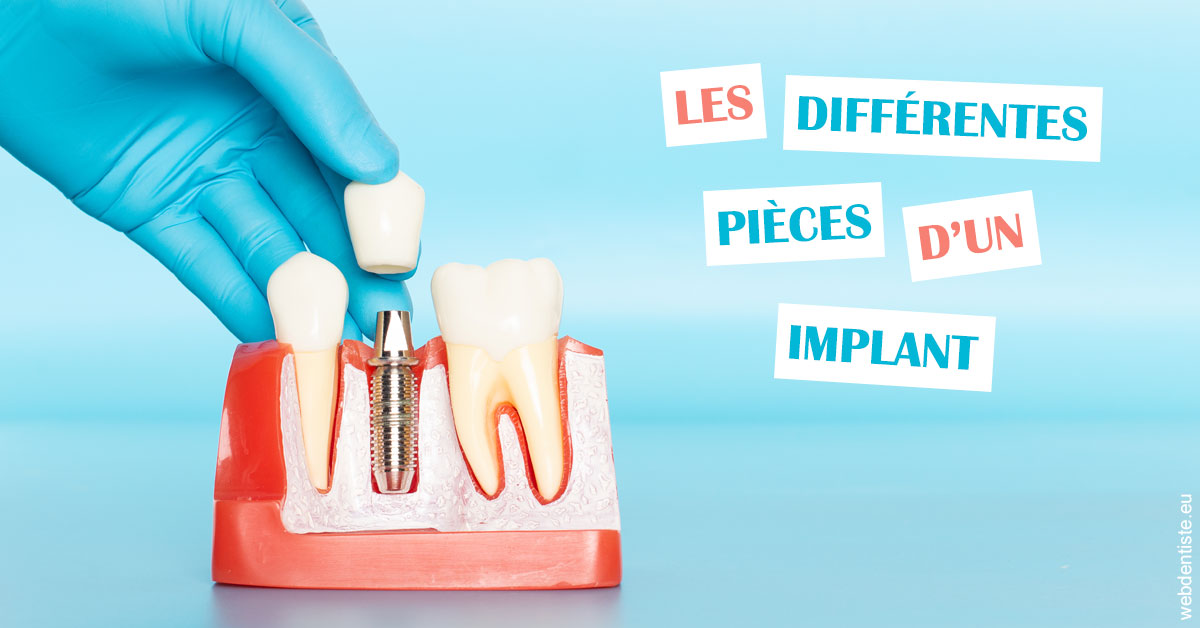 https://dr-zenou-stephane.chirurgiens-dentistes.fr/Les différentes pièces d’un implant 2
