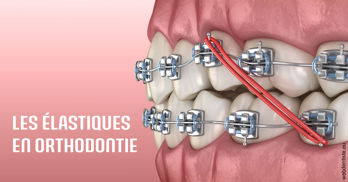 https://dr-zenou-stephane.chirurgiens-dentistes.fr/Elastiques orthodontie 2