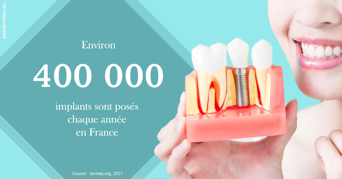 https://dr-zenou-stephane.chirurgiens-dentistes.fr/Pose d'implants en France 2
