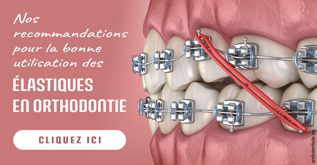 https://dr-zenou-stephane.chirurgiens-dentistes.fr/Elastiques orthodontie 2